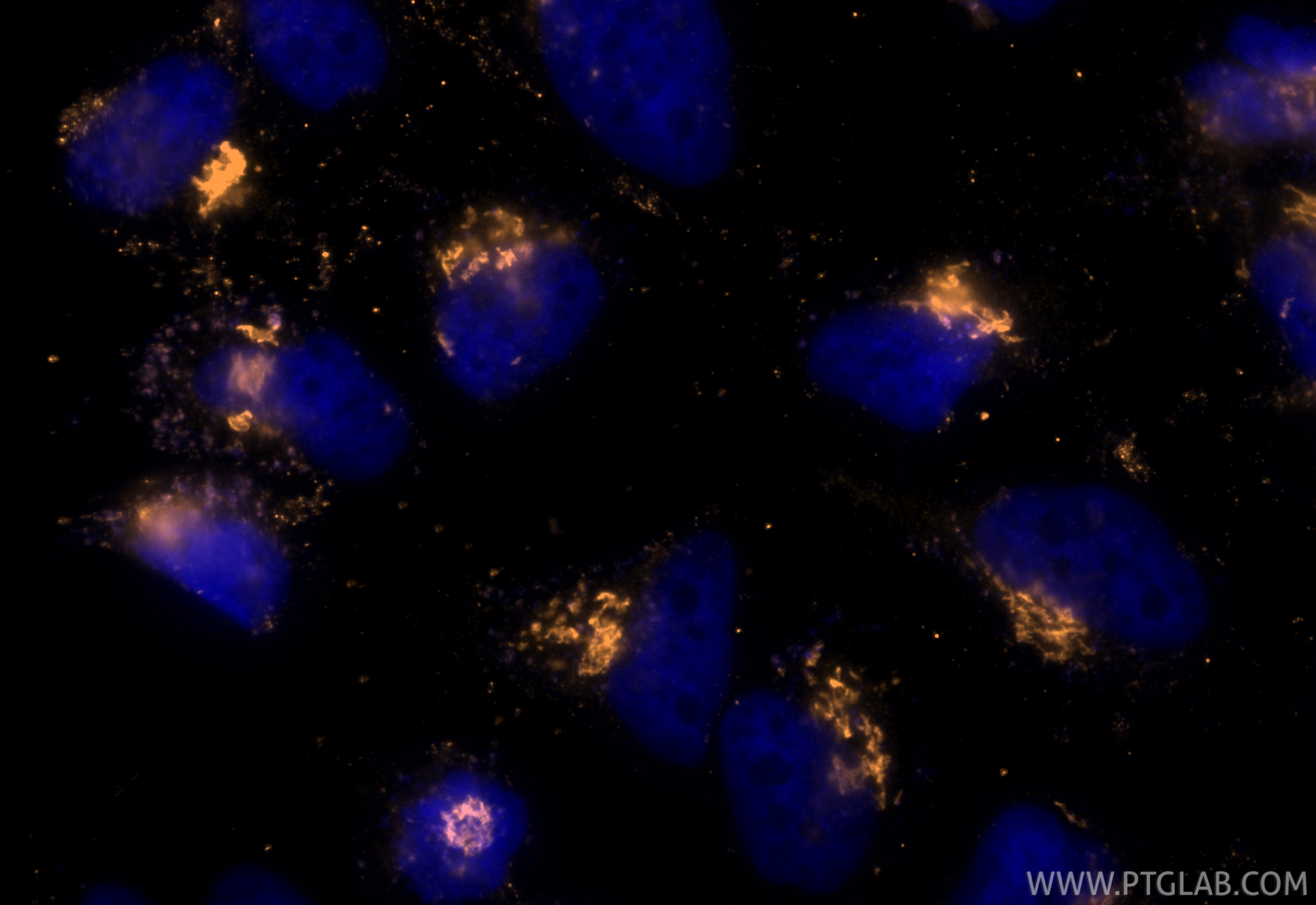 Immunofluorescence (IF) / fluorescent staining of HeLa cells using CoraLite® Plus 555-conjugated GOLGA2/GM130 Recombi (CL555-82705-8)