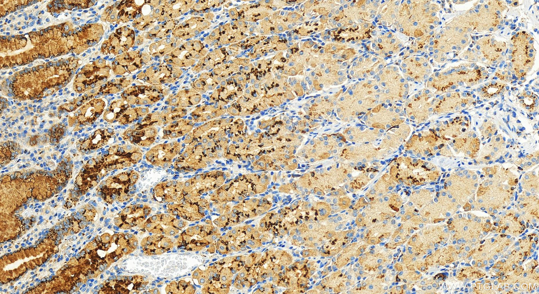 Immunohistochemistry (IHC) staining of human stomach tissue using GP73/GOLPH2 Polyclonal antibody (15126-1-AP)