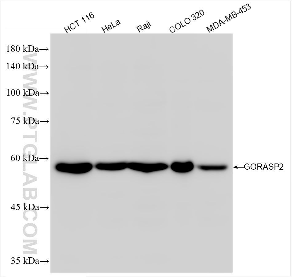 Western Blot (WB) analysis of various lysates using GORASP2 Recombinant antibody (85077-5-RR)