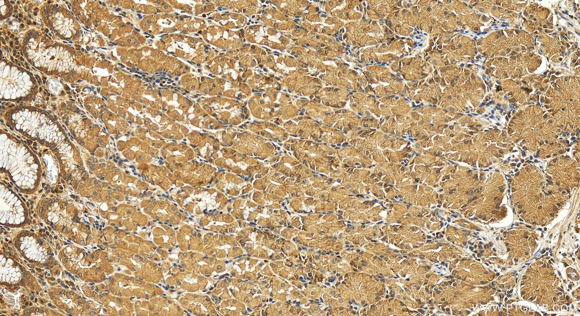 Immunohistochemistry (IHC) staining of human stomach tissue using GOSR2/Membrin Polyclonal antibody (12095-1-AP)