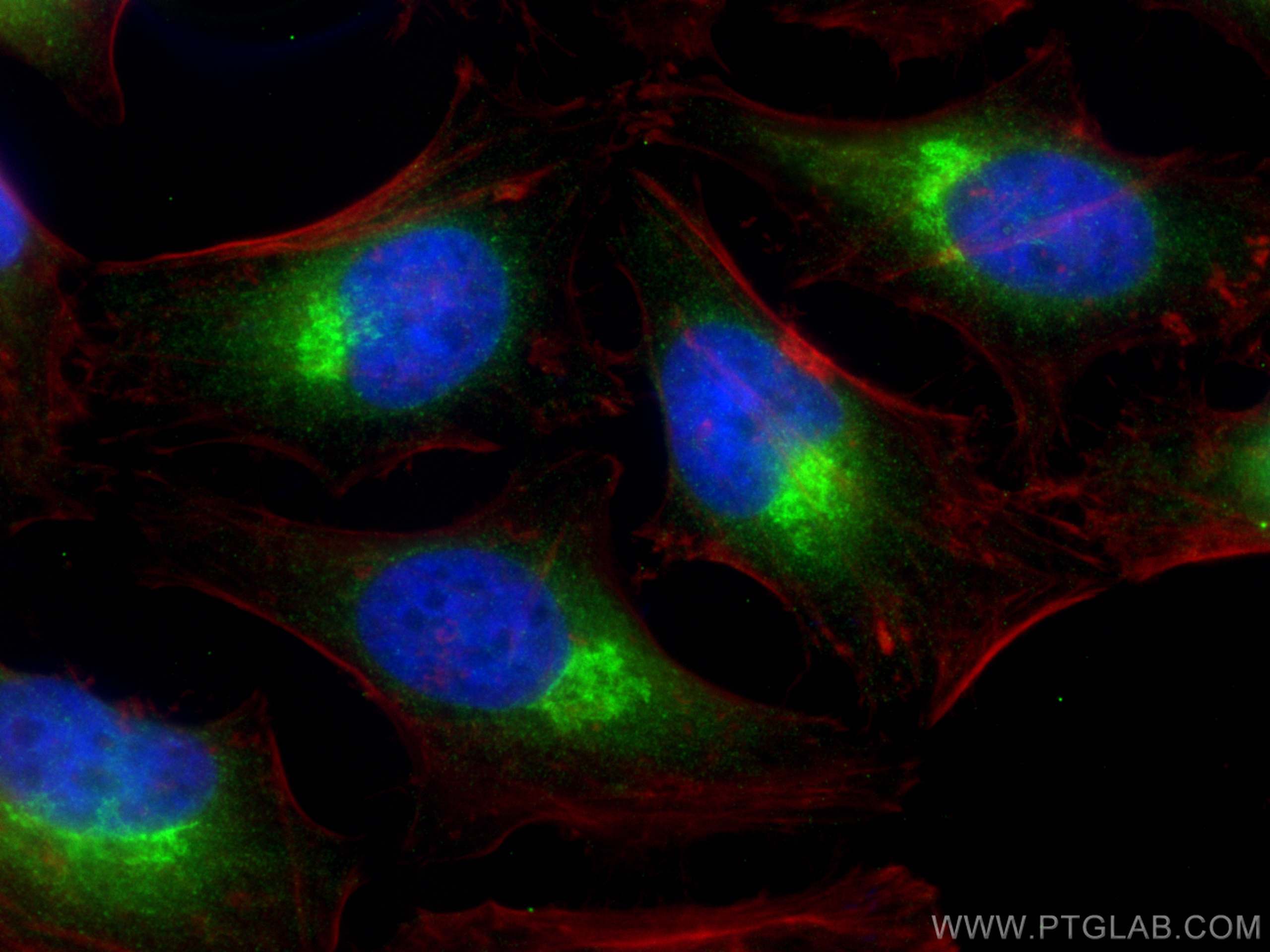 Immunofluorescence (IF) / fluorescent staining of HeLa cells using GOSR2/Membrin Polyclonal antibody (12095-1-AP)