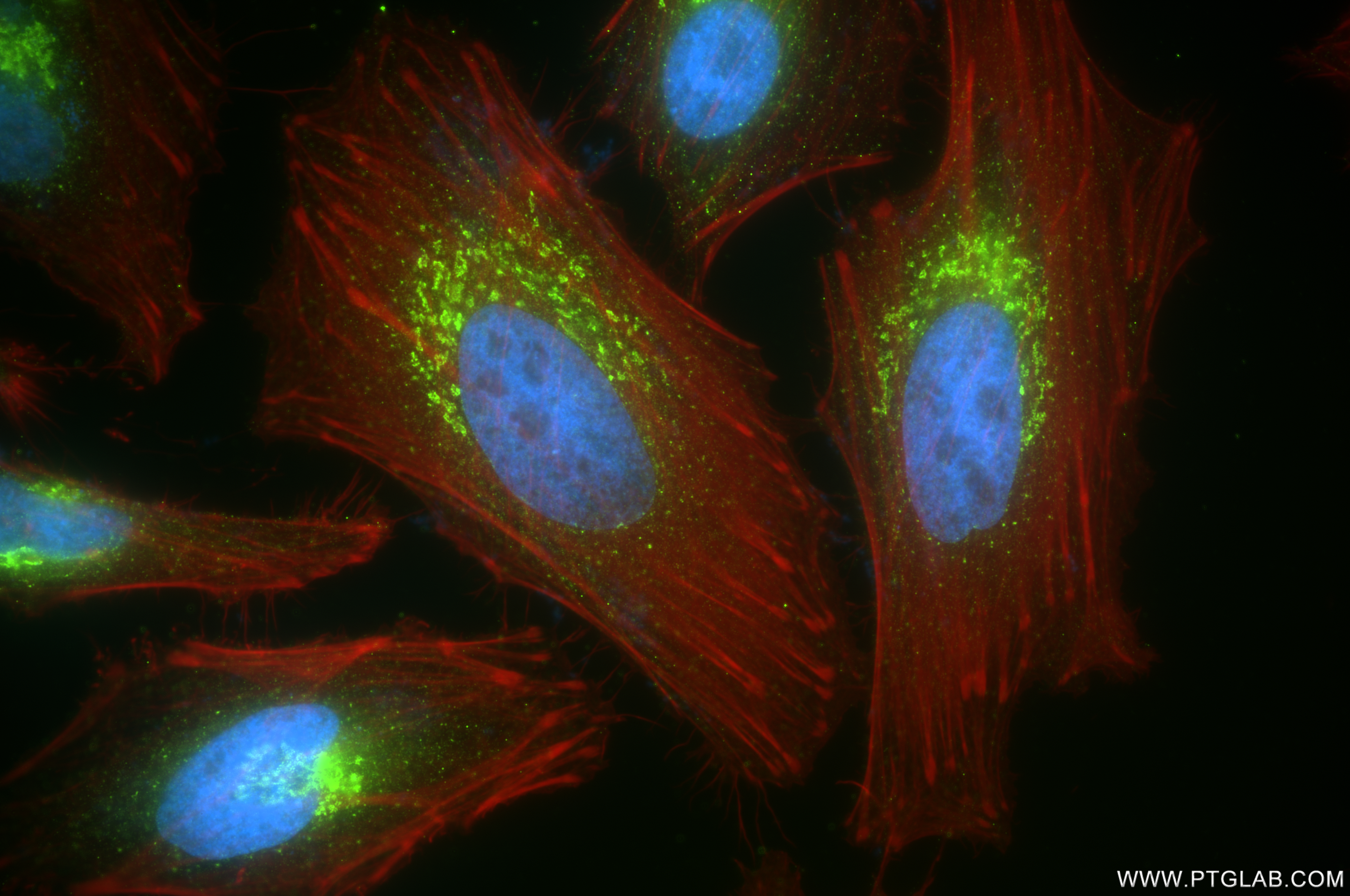 Immunofluorescence (IF) / fluorescent staining of HeLa cells using GOSR2/Membrin Recombinant antibody (84962-4-RR)