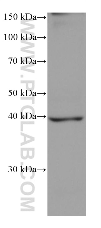 Western Blot (WB) analysis of rat heart tissue using GOT1 Monoclonal antibody (60317-1-Ig)