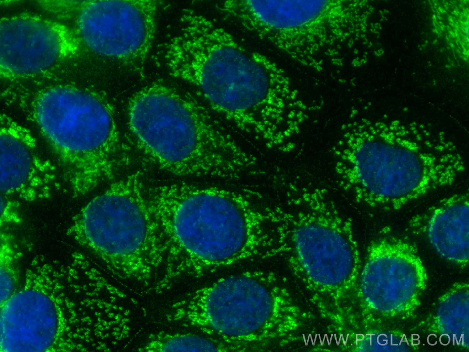 Immunofluorescence (IF) / fluorescent staining of MCF-7 cells using GOT2 Polyclonal antibody (14800-1-AP)