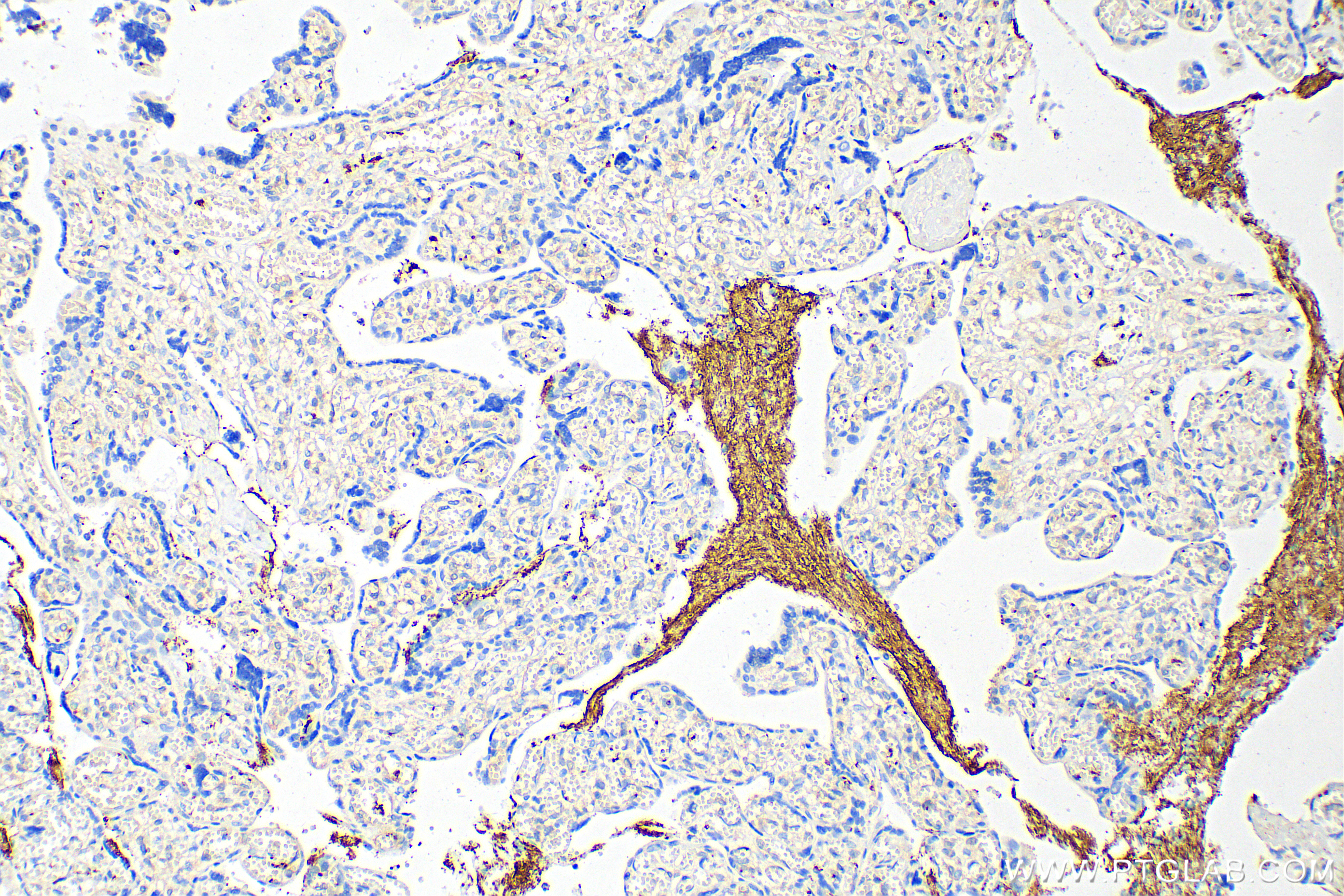 Immunohistochemistry (IHC) staining of human placenta tissue using CD42b Monoclonal antibody (67857-1-Ig)