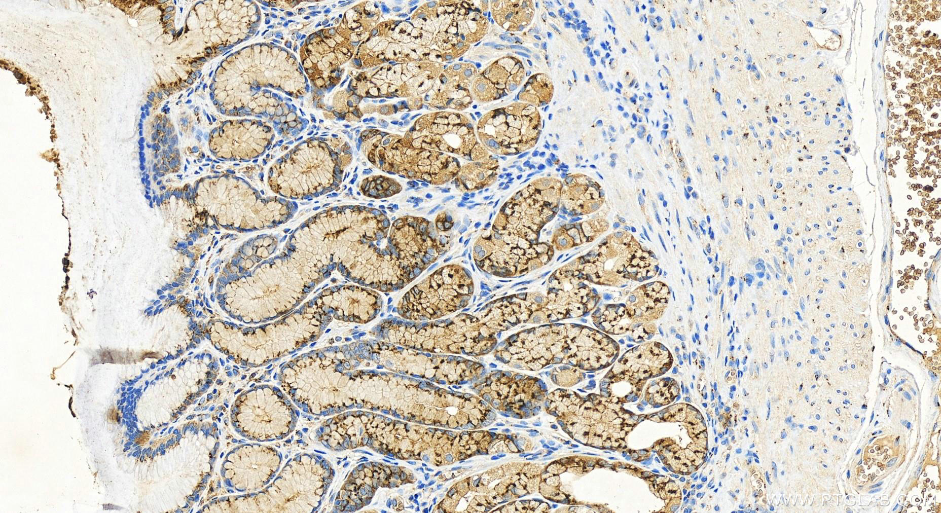 Immunohistochemistry (IHC) staining of human stomach tissue using GP73/GOLPH2 Recombinant antibody (81893-1-RR)