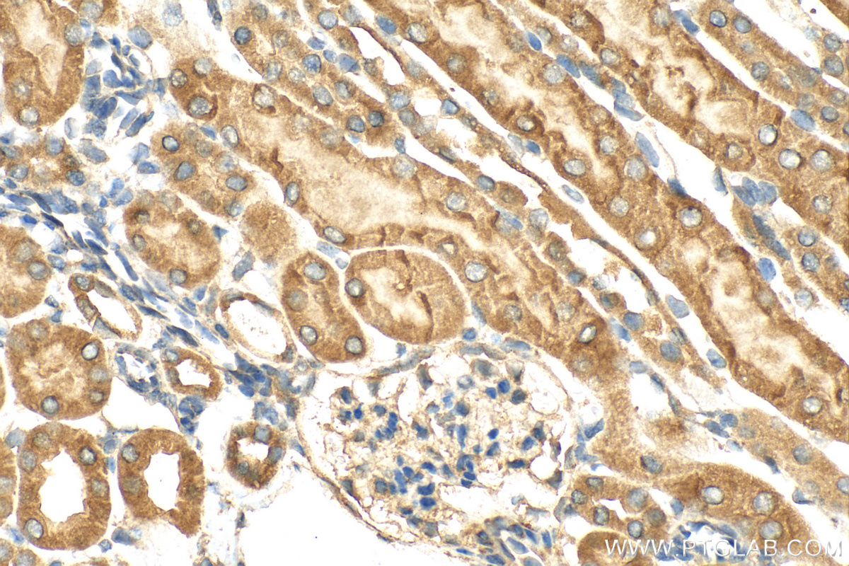 Immunohistochemistry (IHC) staining of mouse kidney tissue using GPAT3 Polyclonal antibody (30765-1-AP)