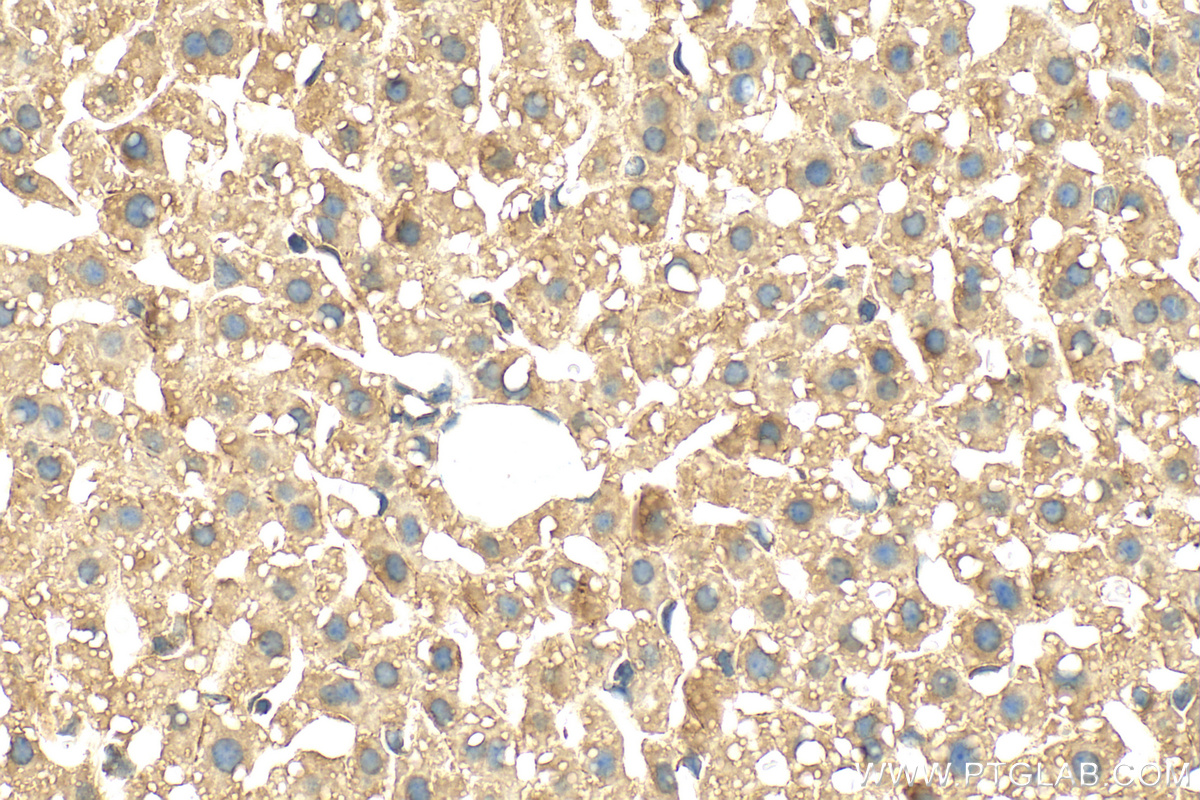 Immunohistochemistry (IHC) staining of mouse liver tissue using GPAT3 Polyclonal antibody (30765-1-AP)