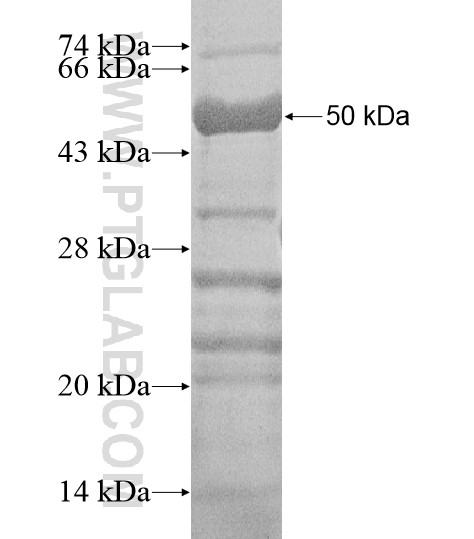 GPATCH4 fusion protein Ag20095 SDS-PAGE