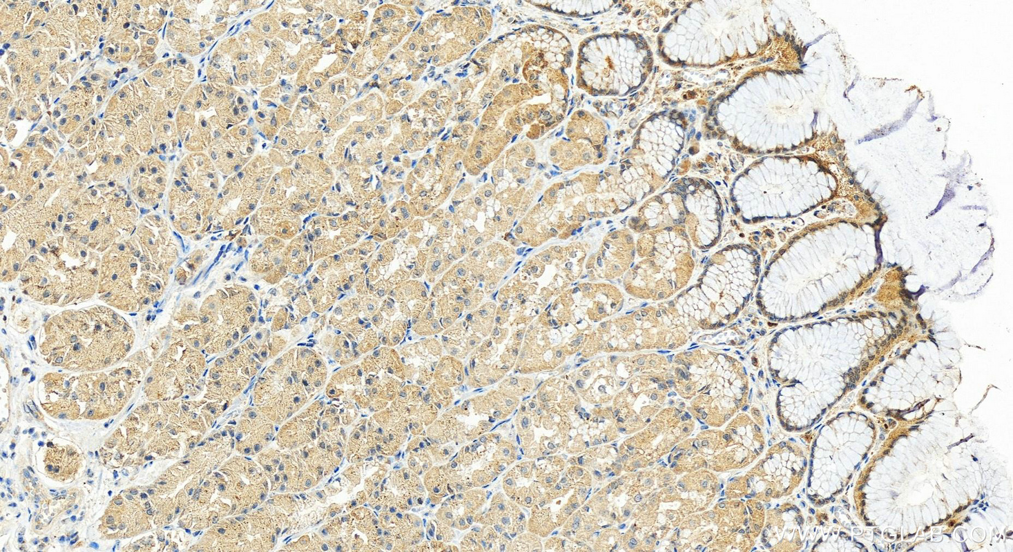 Immunohistochemistry (IHC) staining of human stomach tissue using Glypican 4 Polyclonal antibody (13048-1-AP)