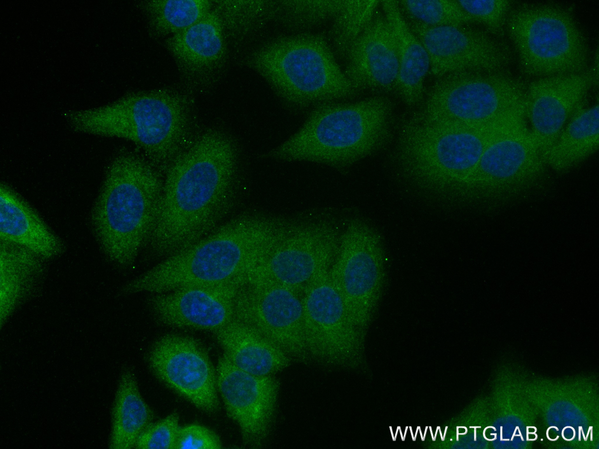 Immunofluorescence (IF) / fluorescent staining of HepG2 cells using GPD1 Recombinant antibody (84800-1-RR)