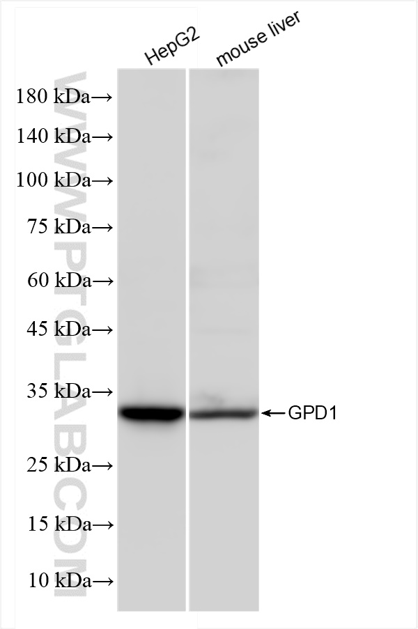 Western Blot (WB) analysis of various lysates using GPD1 Recombinant antibody (84800-1-RR)