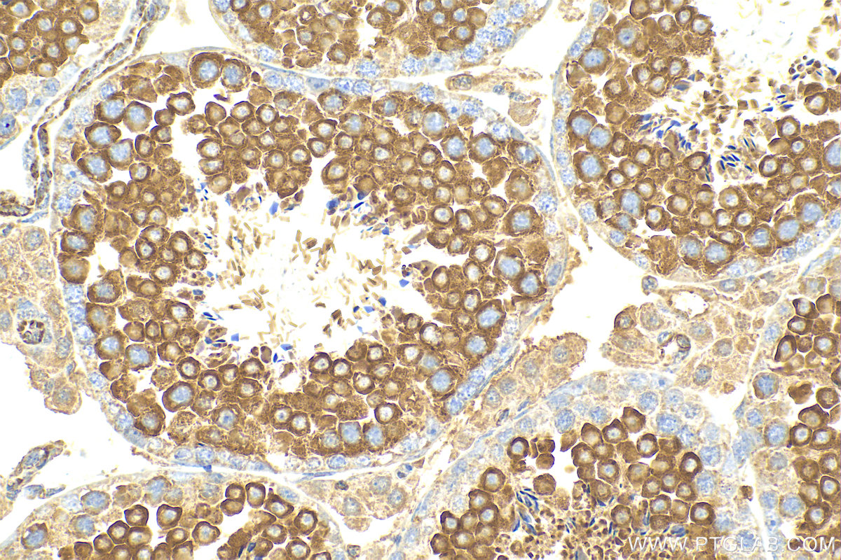 Immunohistochemistry (IHC) staining of mouse testis tissue using GPD2 Polyclonal antibody (17219-1-AP)