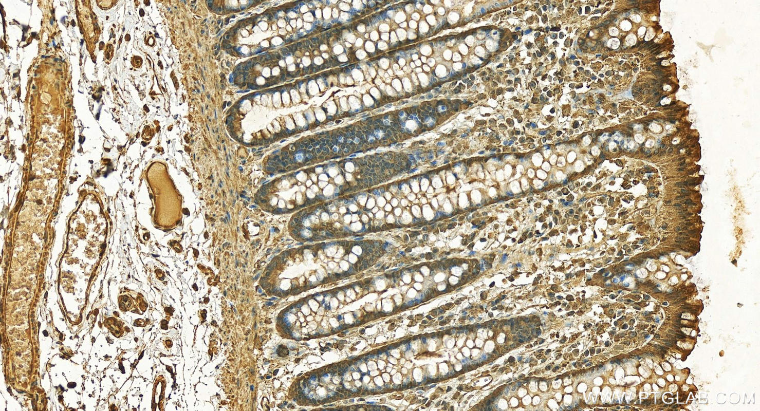 Immunohistochemistry (IHC) staining of human colon tissue using GPI Polyclonal antibody (15171-1-AP)