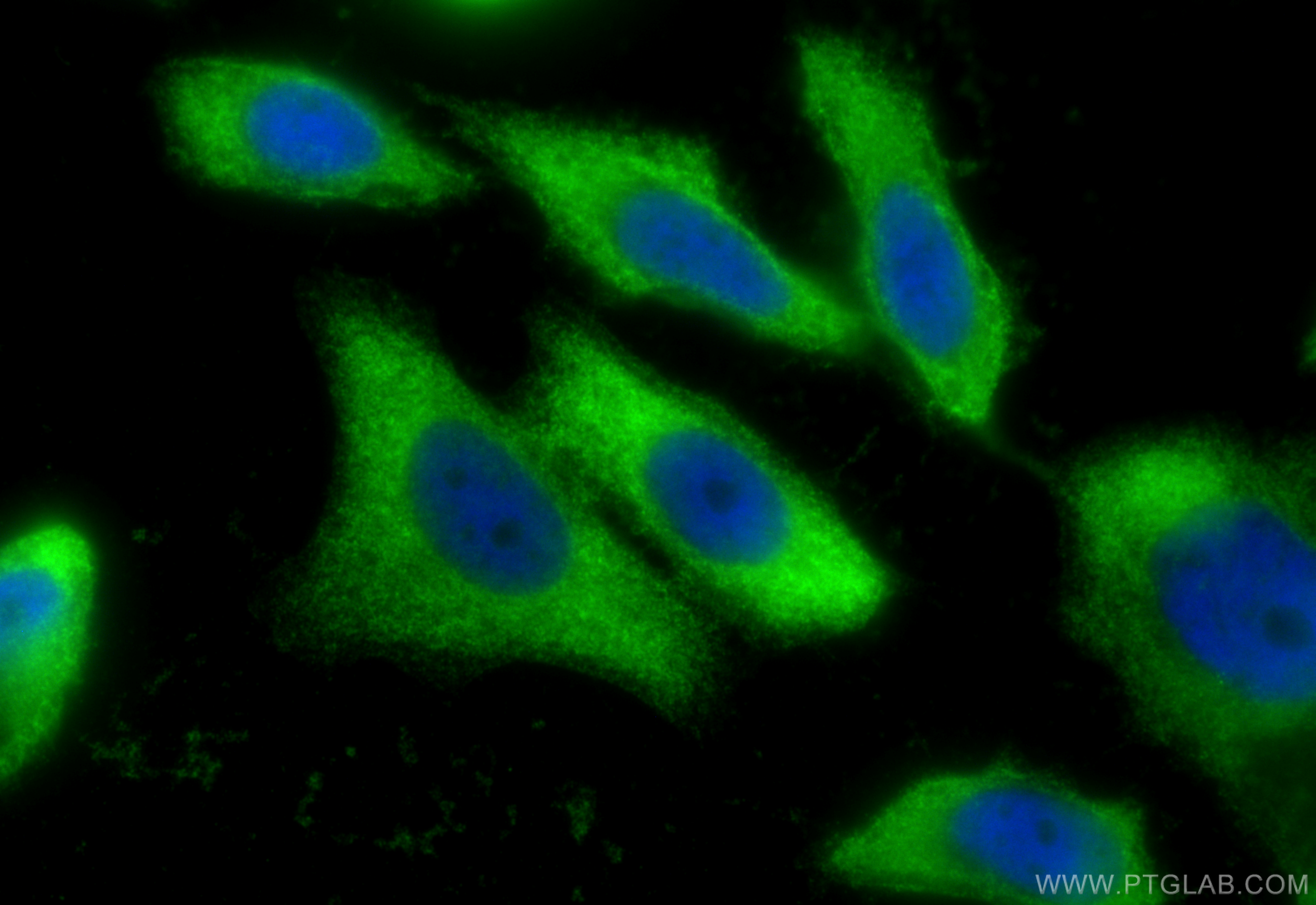 Immunofluorescence (IF) / fluorescent staining of PC-3 cells using GPI Polyclonal antibody (15171-1-AP)