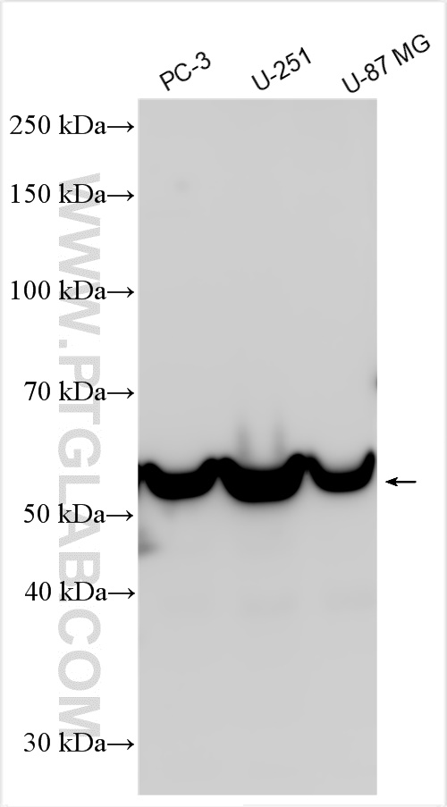 Western Blot (WB) analysis of various lysates using GPI Polyclonal antibody (15171-1-AP)