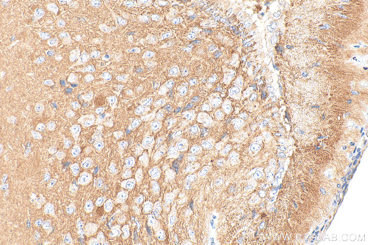 Immunohistochemistry (IHC) staining of mouse brain tissue using Biotin Plus-conjugated GPM6A Polyclonal antibody (Biotin-15044)