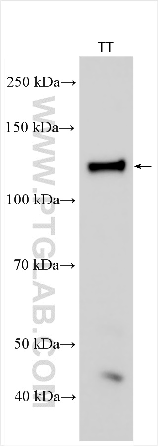 Western Blot (WB) analysis of various lysates using GPNMB Polyclonal antibody (27037-1-AP)