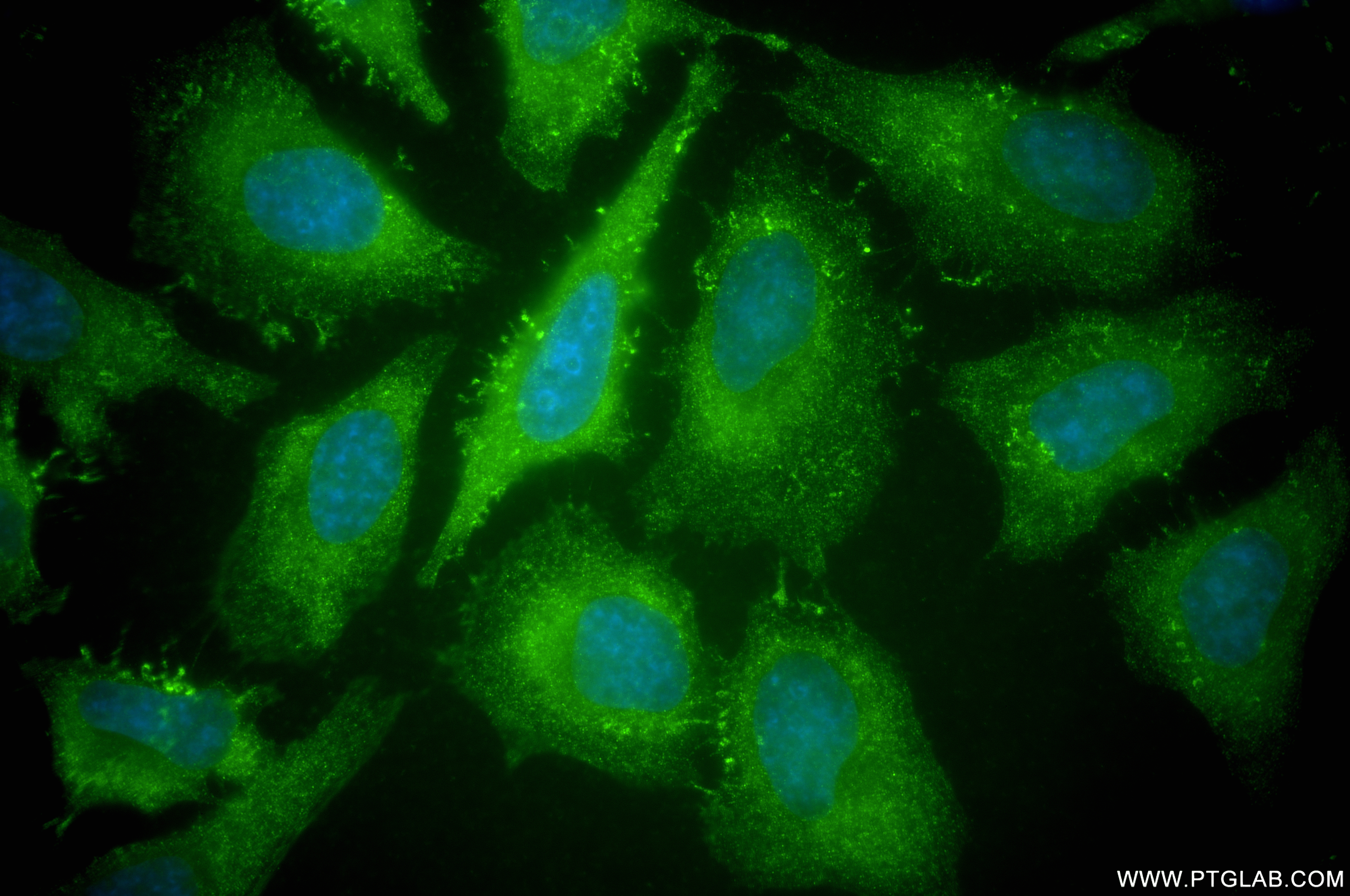 Immunofluorescence (IF) / fluorescent staining of HeLa cells using GPNMB Recombinant antibody (84160-3-RR)