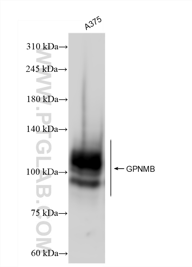 Western Blot (WB) analysis of various lysates using GPNMB Recombinant antibody (84160-3-RR)