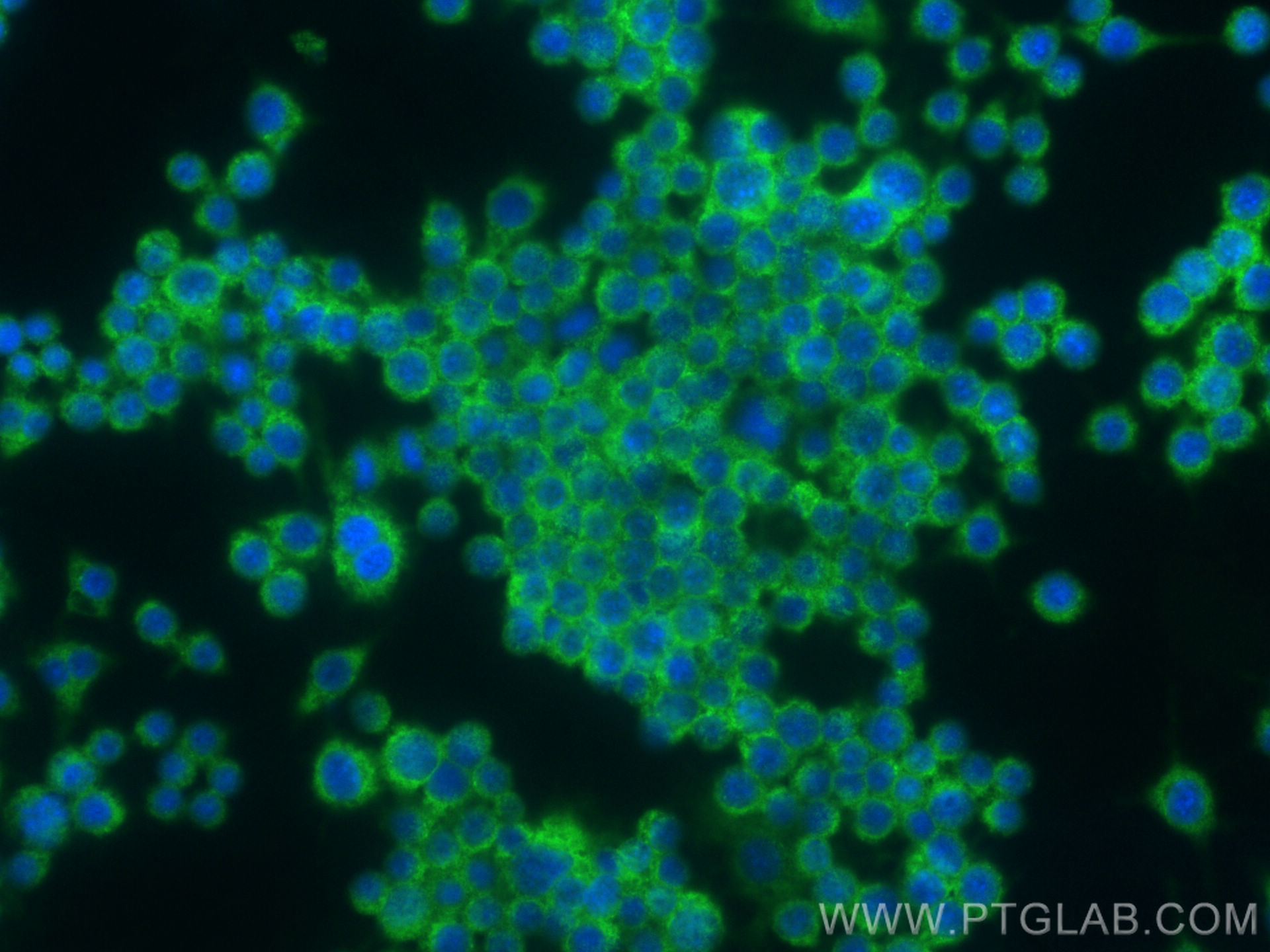 Immunofluorescence (IF) / fluorescent staining of RAW 264.7 cells using GPR112 Polyclonal antibody (31781-1-AP)