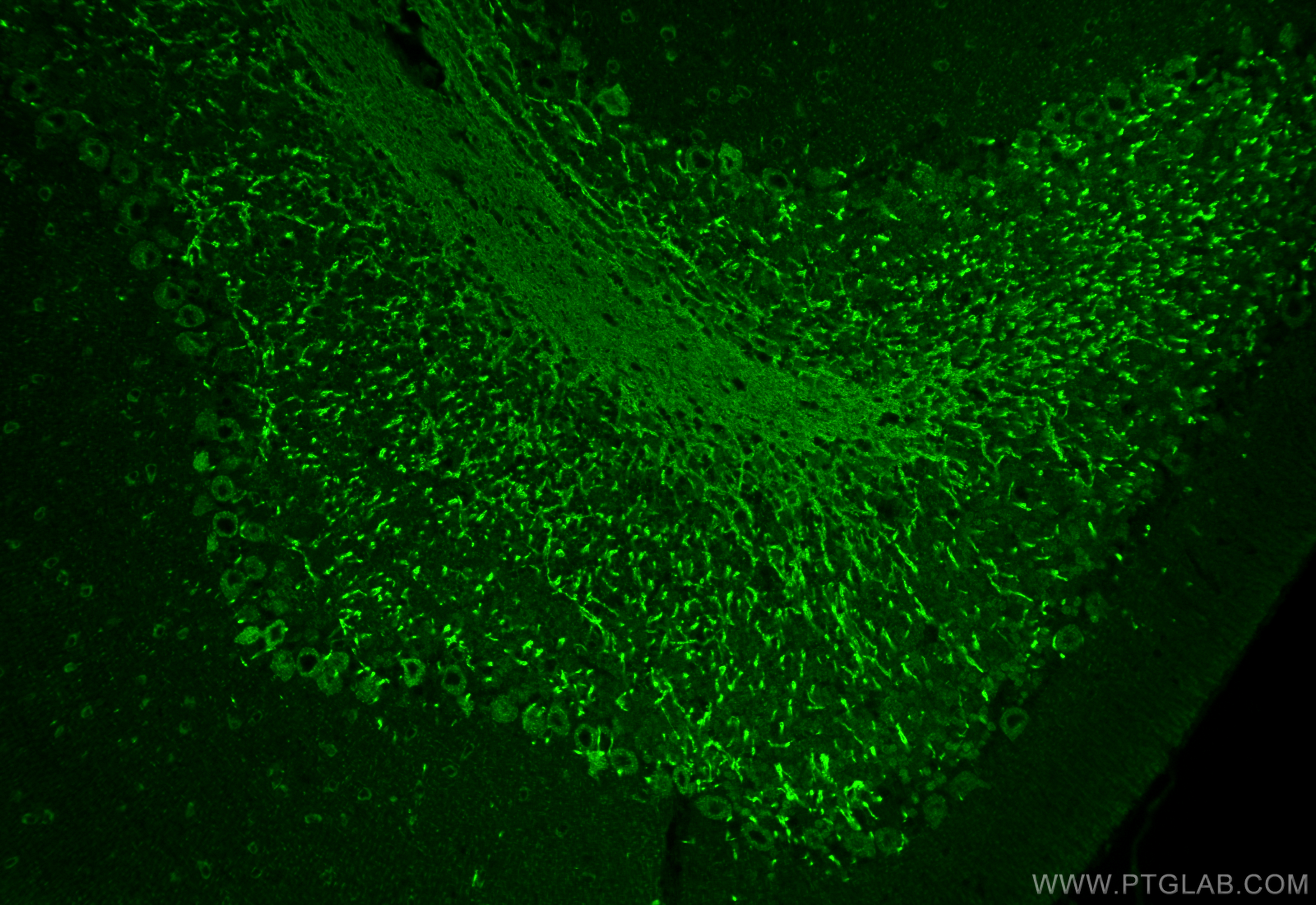 Immunofluorescence (IF) / fluorescent staining of mouse cerebellum tissue using GPR17 Polyclonal antibody (13416-1-AP)