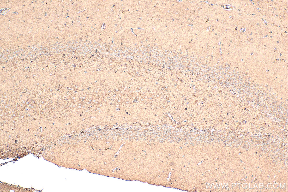 Immunohistochemistry (IHC) staining of rat brain tissue using GPR37/Pael-R Polyclonal antibody (29989-1-AP)