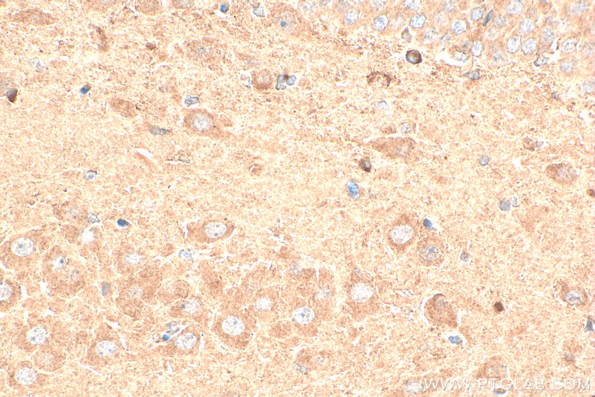Immunohistochemistry (IHC) staining of rat brain tissue using GPR37/Pael-R Polyclonal antibody (29989-1-AP)