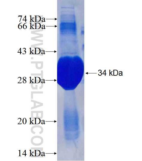 GPR64 fusion protein Ag25489 SDS-PAGE