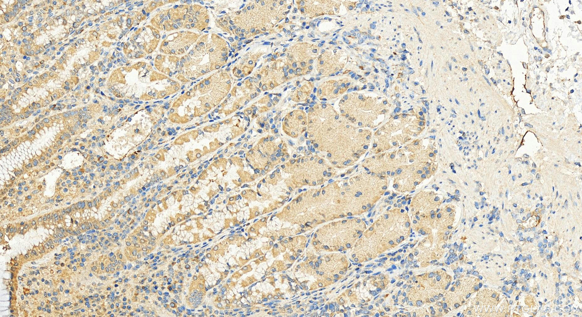 Immunohistochemistry (IHC) staining of human stomach tissue using GPRIN3-Specific Polyclonal antibody (20212-1-AP)