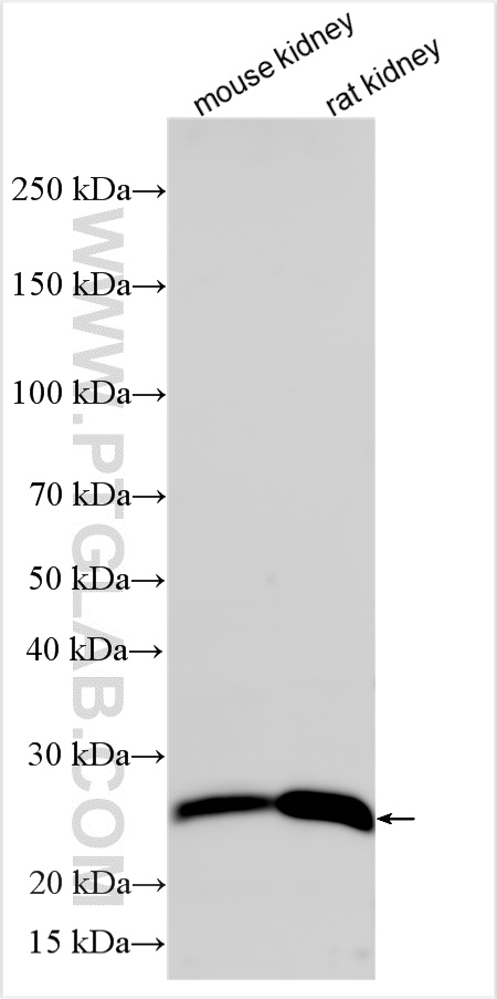 Western Blot (WB) analysis of various lysates using GPX3 Polyclonal antibody (13947-1-AP)