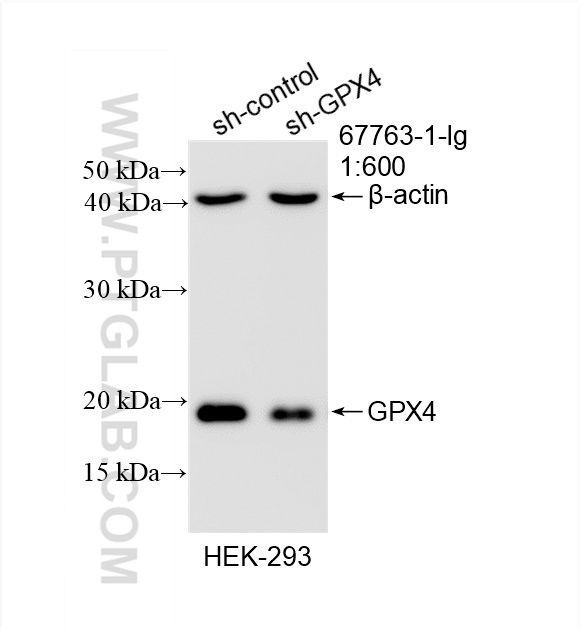 Western Blot (WB) analysis of HEK-293 cells using GPX4 Monoclonal antibody (67763-1-Ig)