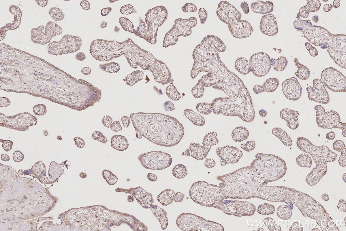 Immunohistochemistry (IHC) staining of human placenta tissue using GRASP65,GORASP1 Polyclonal antibody (10747-2-AP)