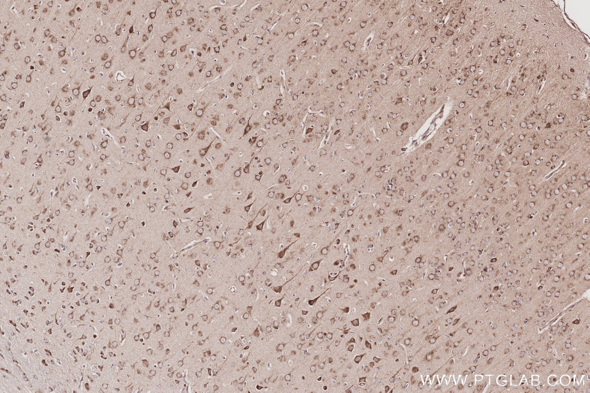 Immunohistochemistry (IHC) staining of rat brain tissue using GRASP65,GORASP1 Polyclonal antibody (10747-2-AP)