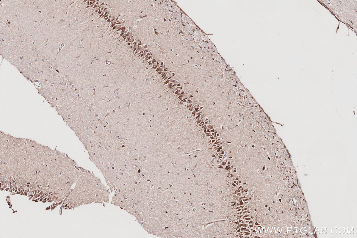 Immunohistochemistry (IHC) staining of rat brain tissue using GRASP65,GORASP1 Polyclonal antibody (10747-2-AP)