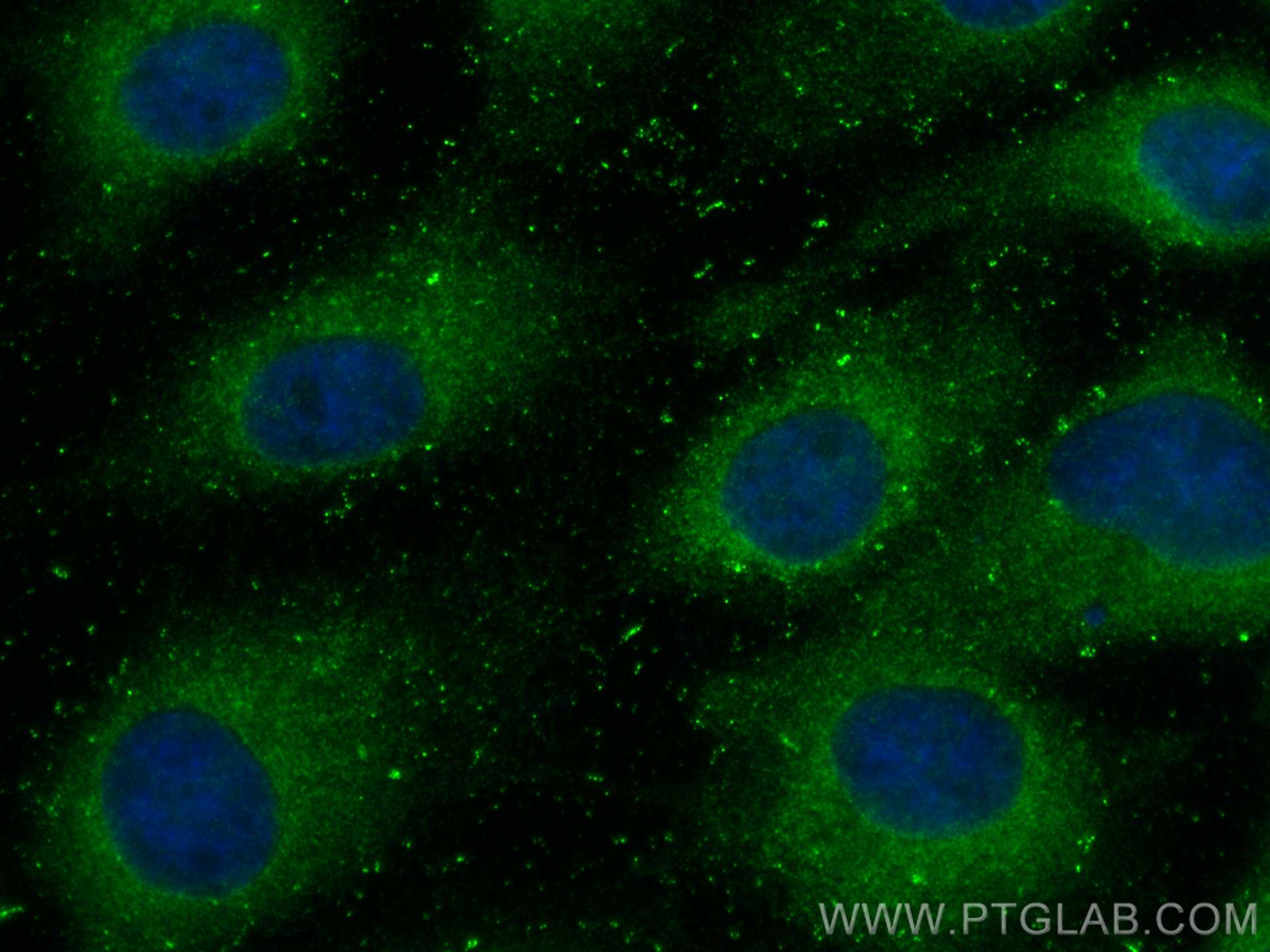 Immunofluorescence (IF) / fluorescent staining of A431 cells using GRB7 Polyclonal antibody (10045-1-Ig)