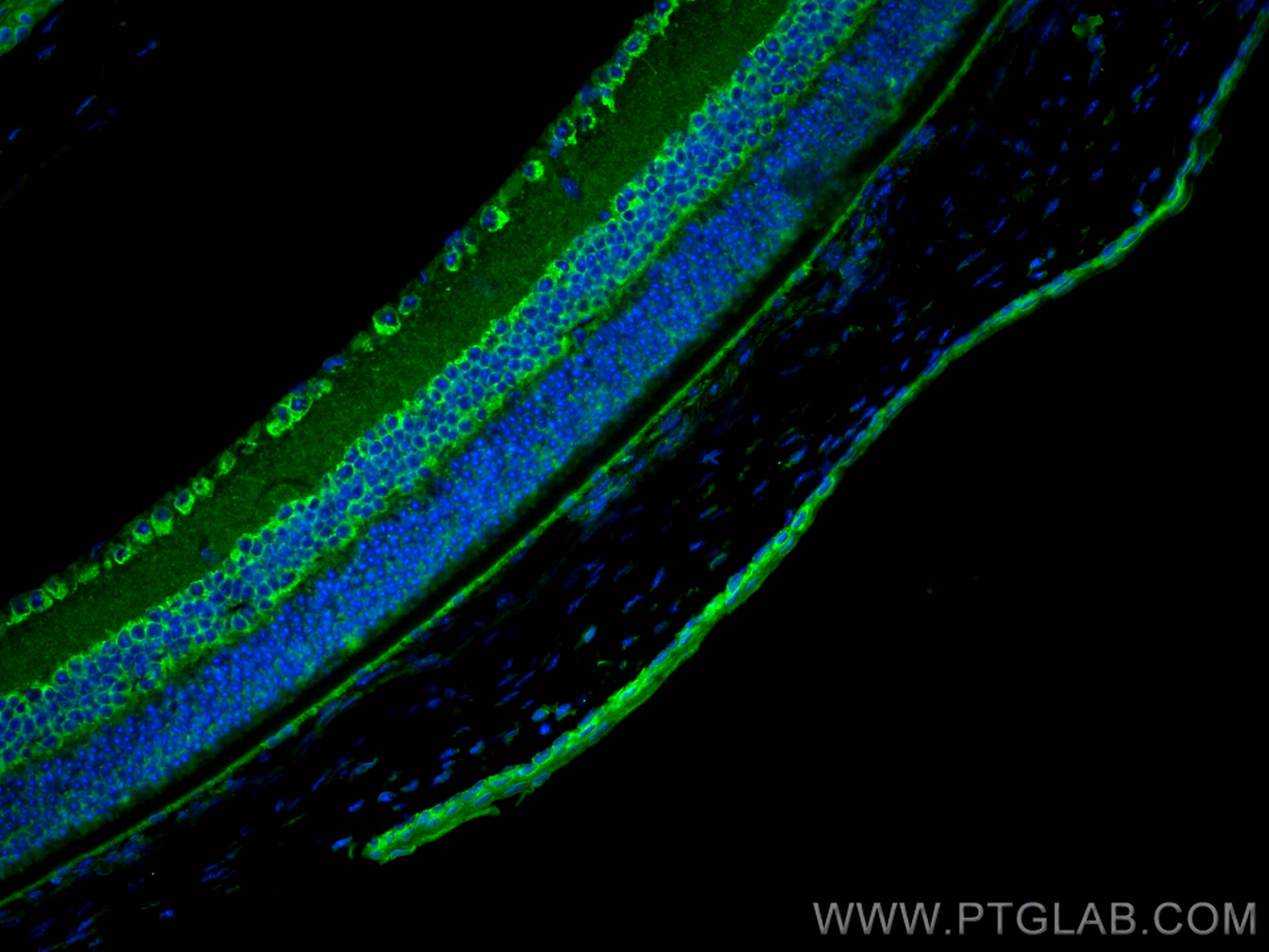 Immunofluorescence (IF) / fluorescent staining of mouse eye tissue using Glutamate receptor 2 Polyclonal antibody (11994-1-AP)