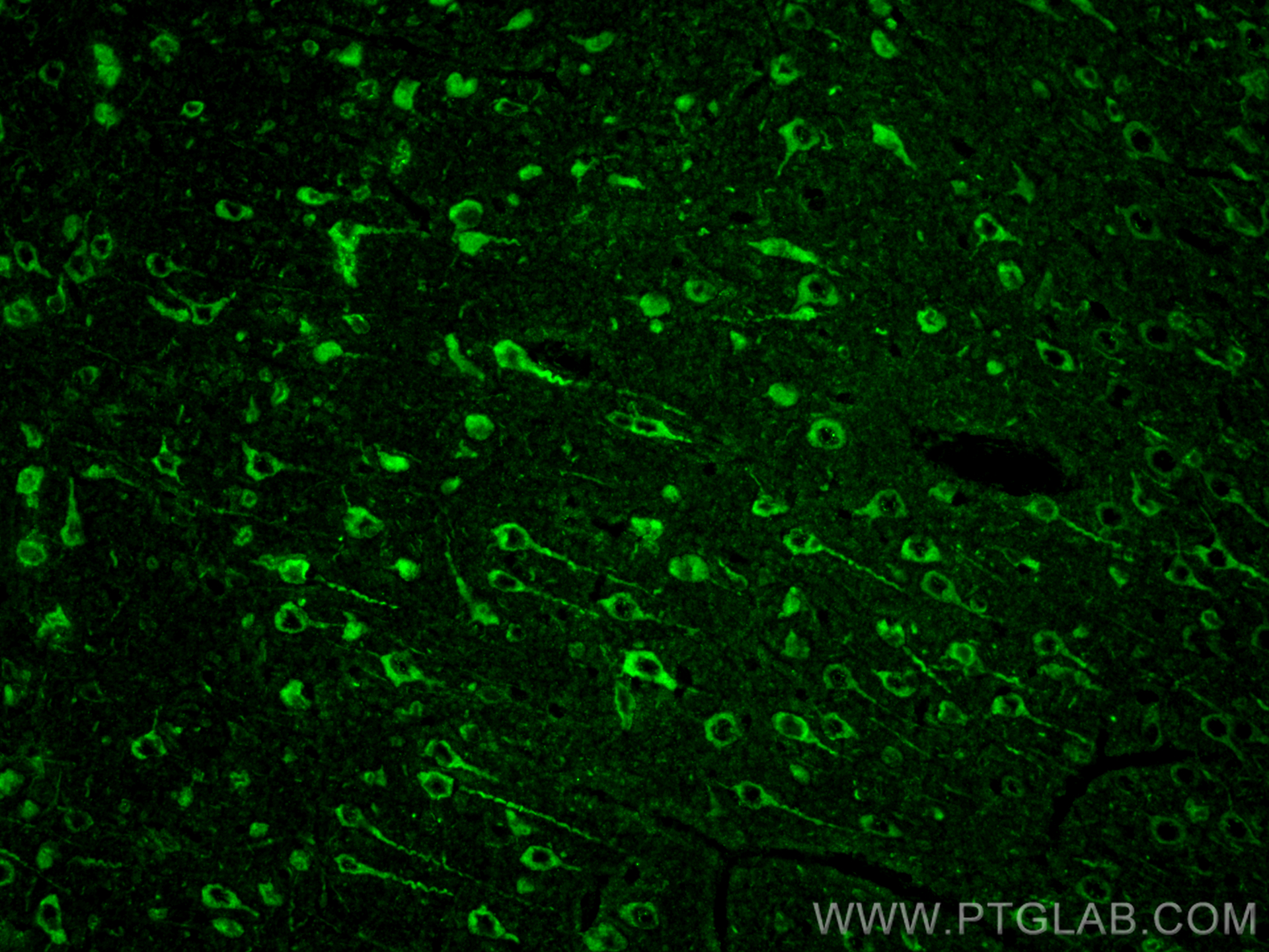 Immunofluorescence (IF) / fluorescent staining of rat brain tissue using Glutamate receptor 3/GluA3 Polyclonal antibody (29588-1-AP)