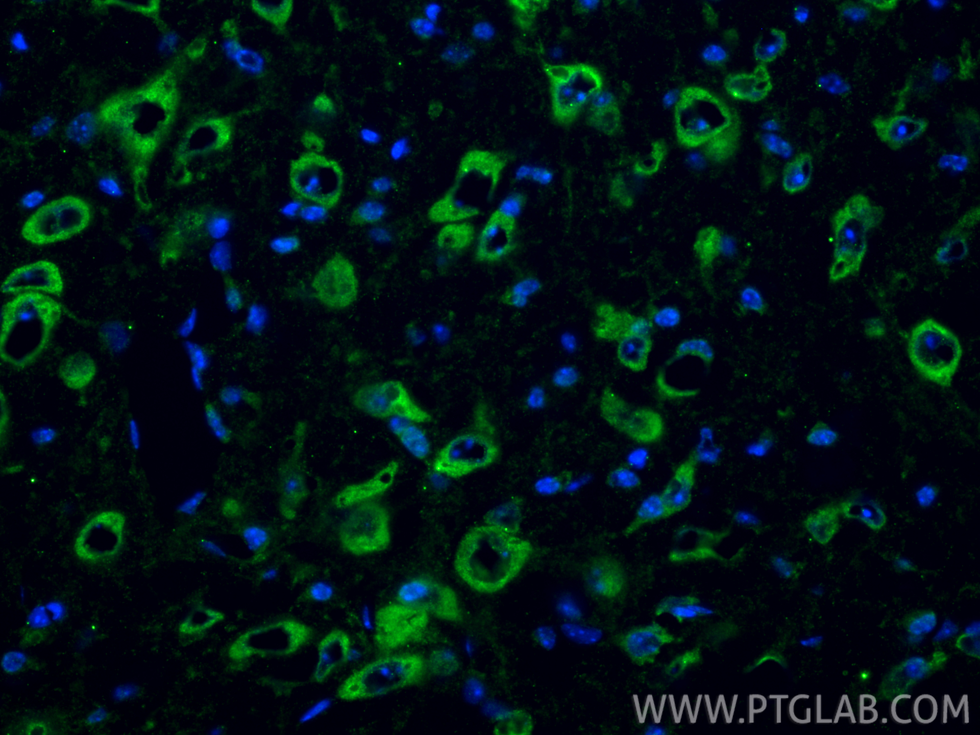 Immunofluorescence (IF) / fluorescent staining of mouse brain tissue using NMDAR1/GRIN1 Polyclonal antibody (27676-1-AP)