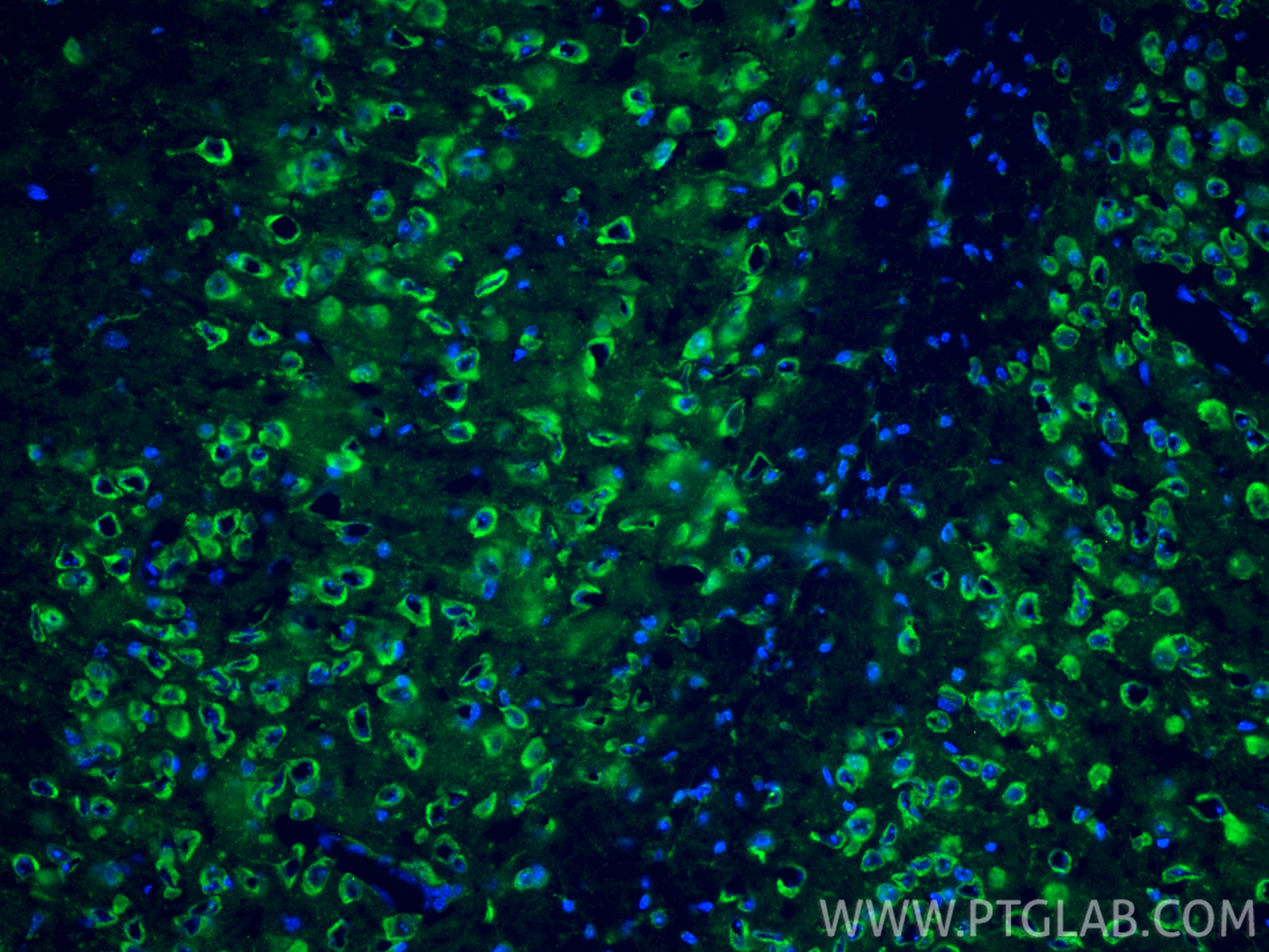 Immunofluorescence (IF) / fluorescent staining of mouse brain tissue using NMDAR2B/GRIN2B Polyclonal antibody (21920-1-AP)