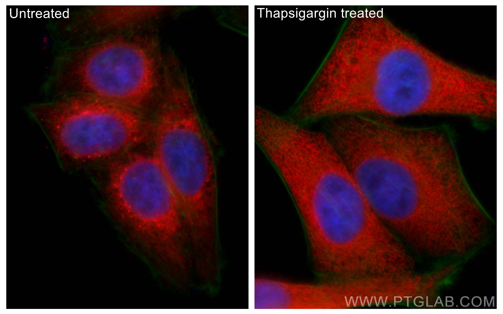 Immunofluorescence (IF) / fluorescent staining of HepG2 cells using GRP78/BIP Polyclonal antibody (11587-1-AP)