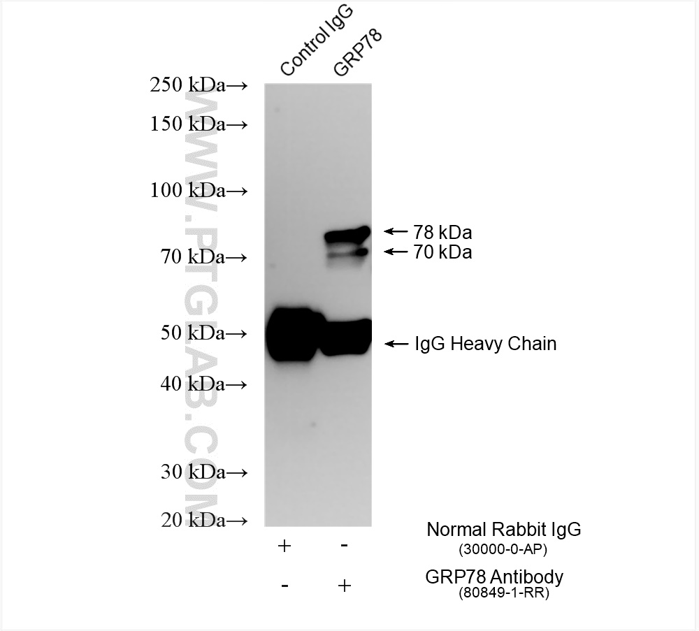 Immunoprecipitation (IP) experiment of HeLa cells using GRP78,BIP Recombinant antibody (80849-1-RR)