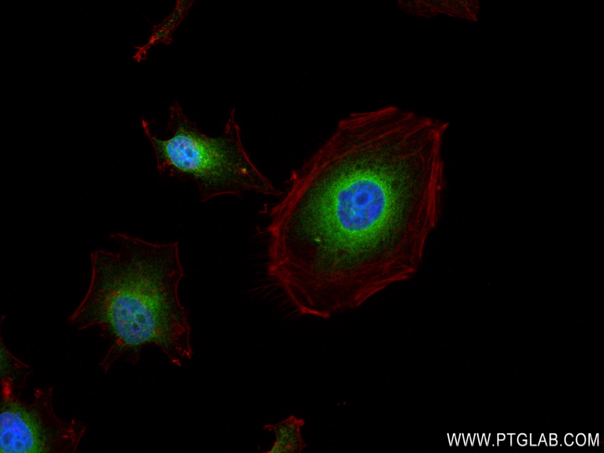Immunofluorescence (IF) / fluorescent staining of HeLa cells using GRP94 Recombinant antibody (83147-5-RR)