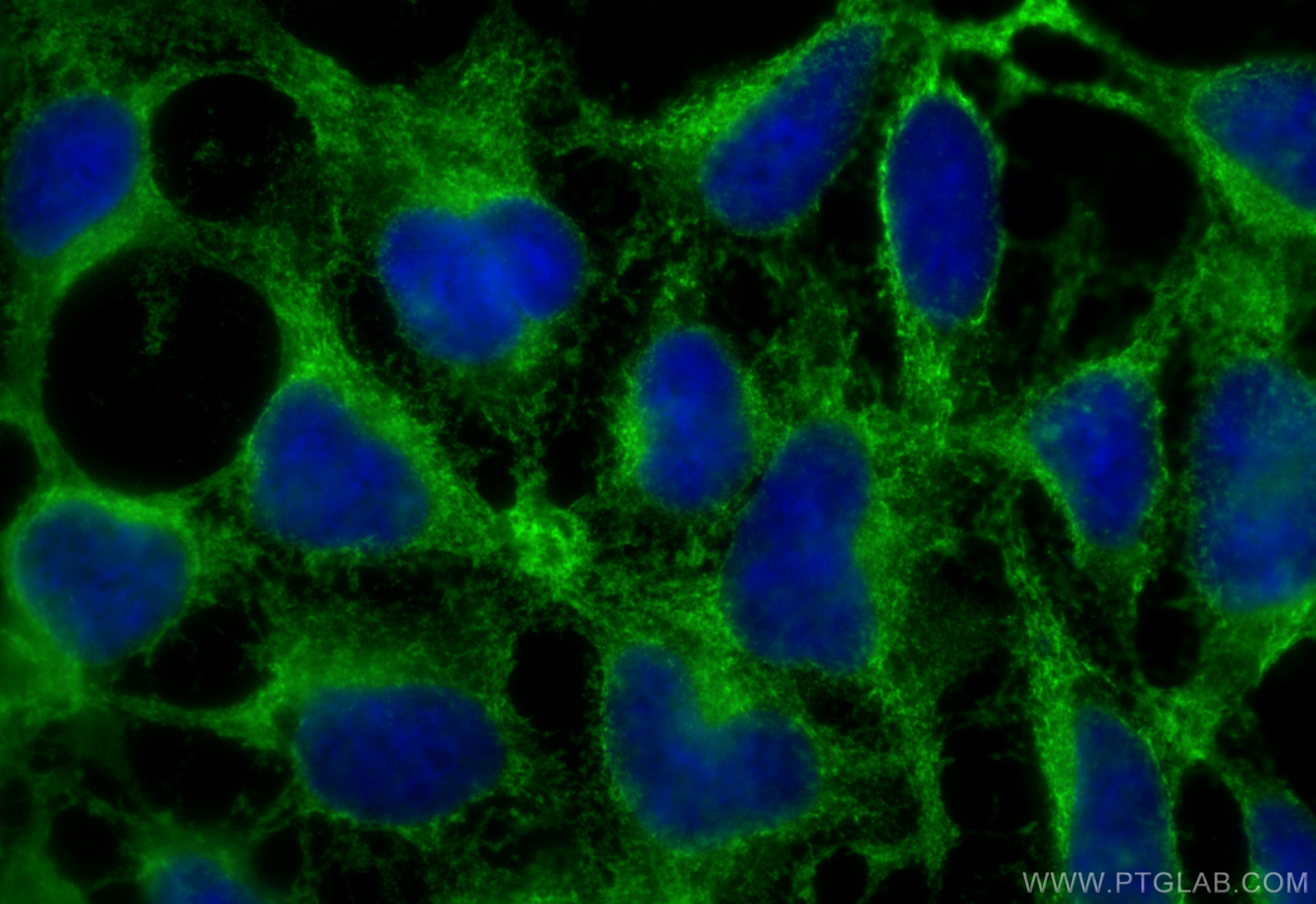 Immunofluorescence (IF) / fluorescent staining of HEK-293 cells using GRP94 Recombinant antibody (83147-5-RR)