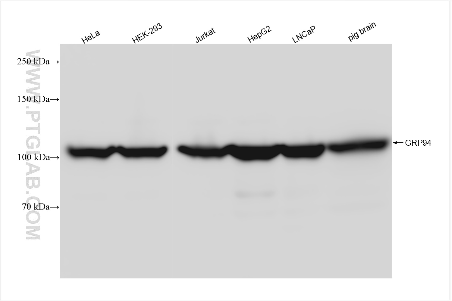Western Blot (WB) analysis of various lysates using GRP94 Recombinant antibody (83147-5-RR)