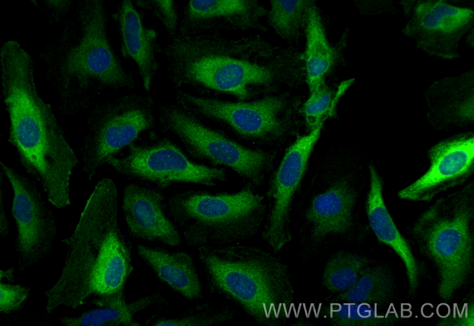 Immunofluorescence (IF) / fluorescent staining of HeLa cells using GSDMA Recombinant antibody (82920-2-RR)