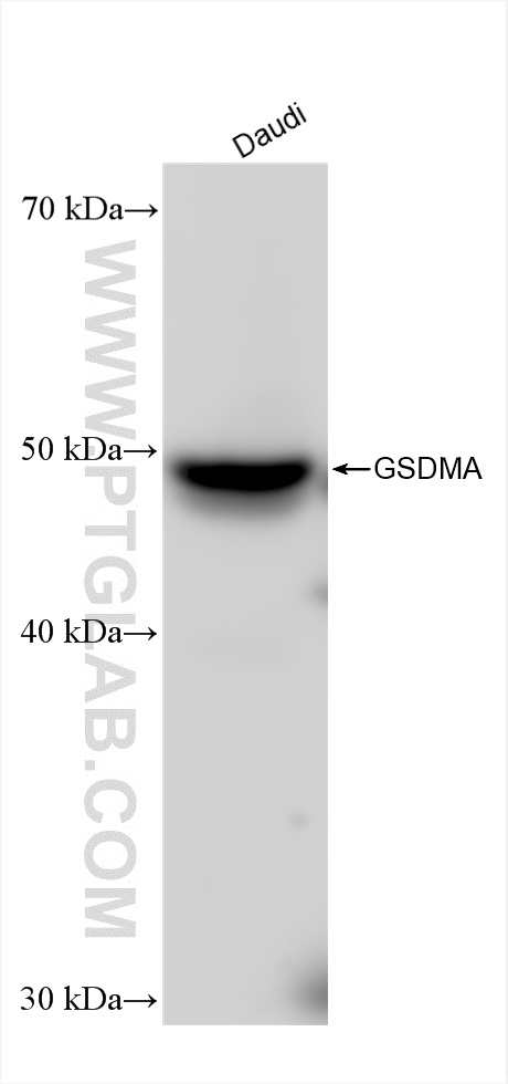 Western Blot (WB) analysis of various lysates using GSDMA Recombinant antibody (82920-2-RR)