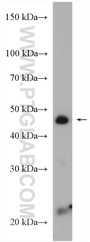 Western Blot (WB) analysis of A431 cells using GSDMB Polyclonal antibody (12885-1-AP)