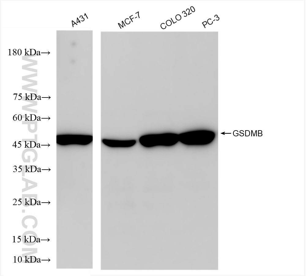 Western Blot (WB) analysis of various lysates using GSDMB Recombinant antibody (86148-1-RR)
