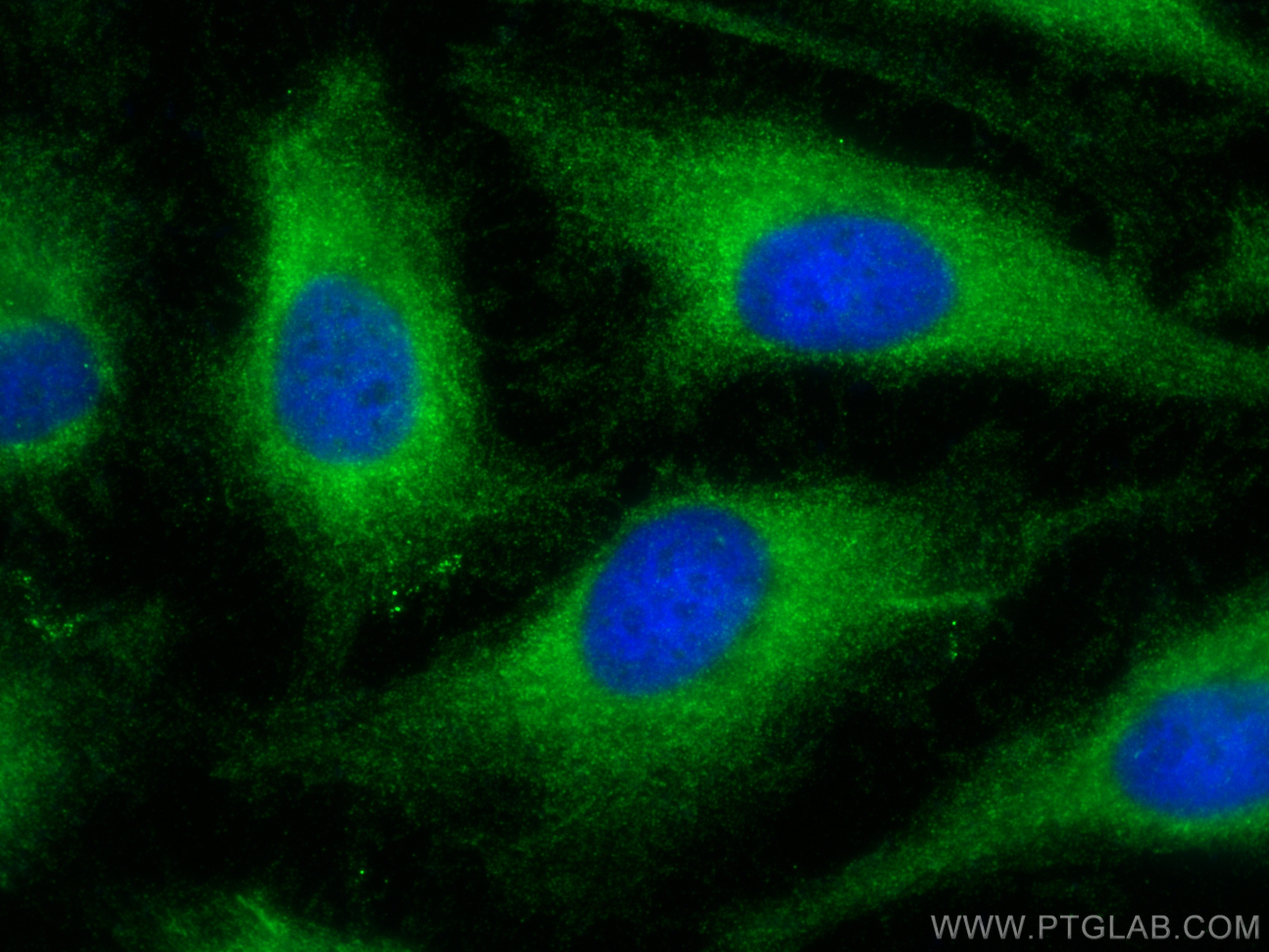 Immunofluorescence (IF) / fluorescent staining of HeLa cells using GSDMD  Polyclonal antibody (20770-1-AP)